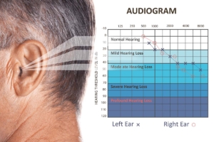 L'audiogramma è il risultato del test audiometrico 